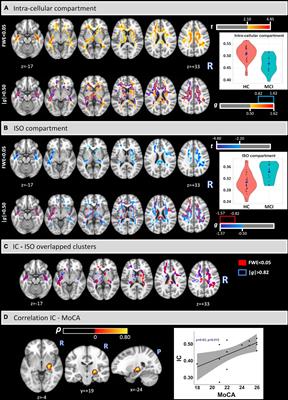 Analysis of Brain Structural Connectivity Networks and White Matter Integrity in Patients With Mild Cognitive Impairment